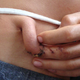 Illustration for article titled Man Grows New Fingertip On His Stomach (Warning: Gross)